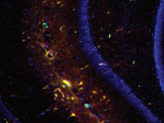 blood-brain400x300 Researchers cross blood-brain barrier with glucose