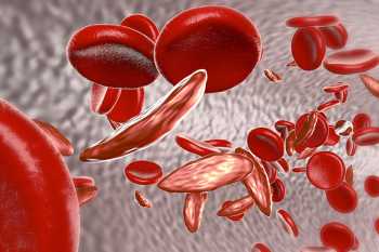 European Commission approves CRISPR/Cas9 gene-edited therapy, CASGEVY for sickle cell disease and transfusion-dependent beta thalassemia