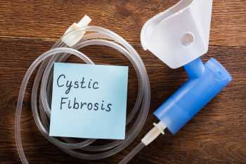 New spin out will develop rapid diagnostic kits for people with cystic fibrosis