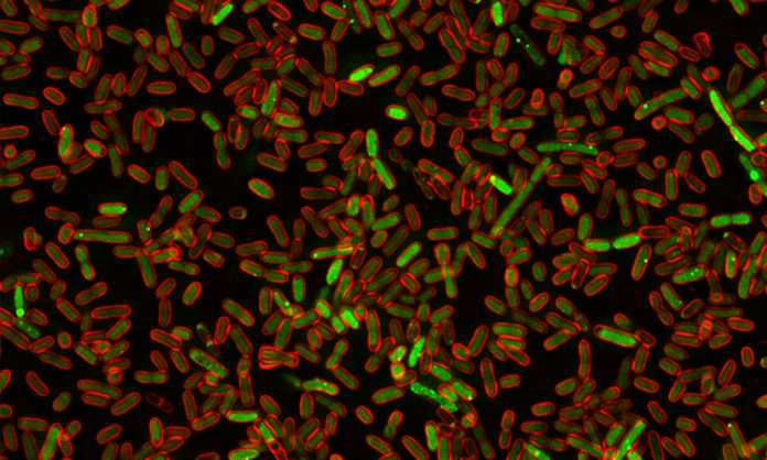 rdg_ecoli830 Bacteria effect on human proteins paves way for new cancer treatments