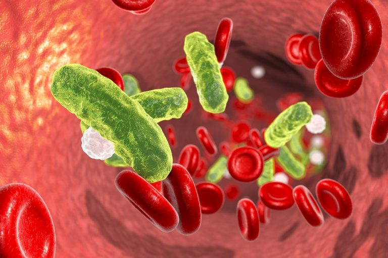 European study highlights the utility of Beckman Coulter’s MDW biomarker for the earlier detection of sepsis in A&E